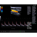 Krankenhaus benutzte 3D 4D Ultraschallscanner &amp; Farbdopplerpreis